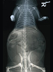 X-ray